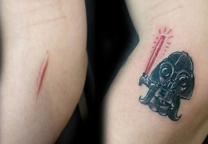 When Scars Become Art